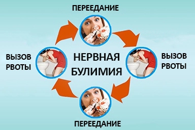 Лечение булимии в Тарусе